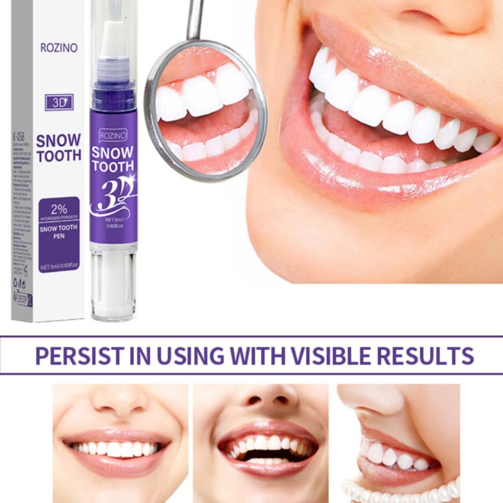 Stylo blanchissant pour dents  - Teeth Whitening Pens avis et prix